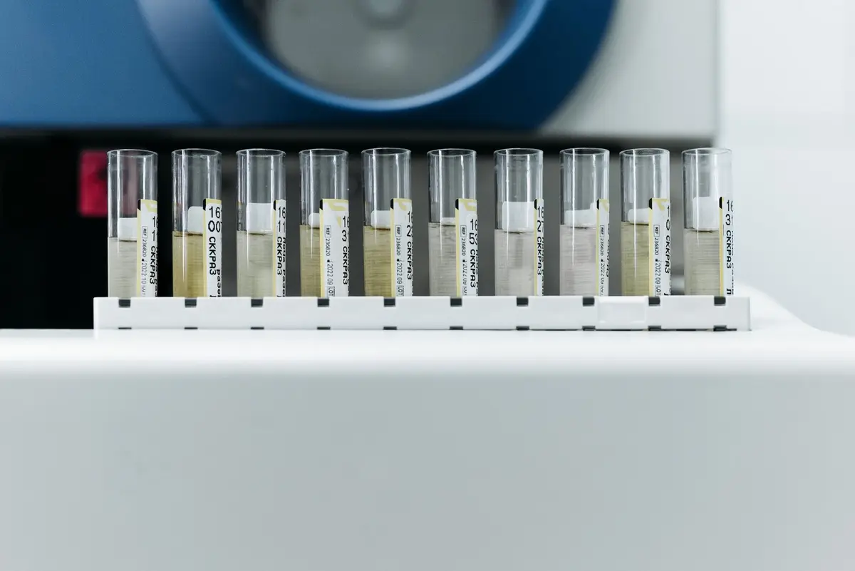 Em destaque: DESTAQUE Biopsia liquida avanca no pais para deteccao precoce de cancer