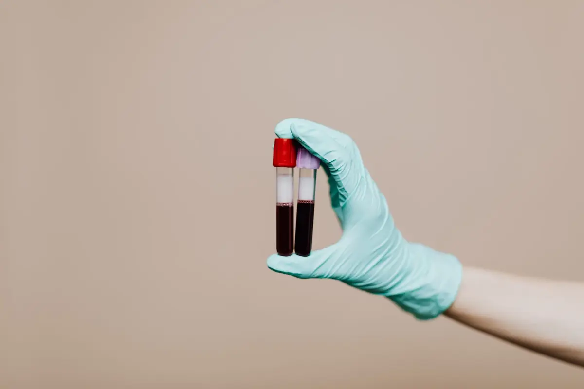 Atualização: Saúde Exame molecular do sus aponta quase 10 mil casos de hpv de alto risco