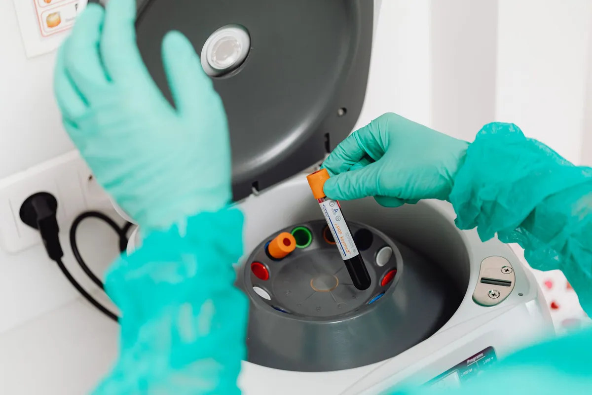 Exames de sangue ajudam a avançar no diagnóstico de alzheimer